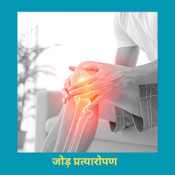 जोड़ प्रत्यारोपण